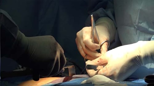 Surgeon's Hands and Medical Gloves
