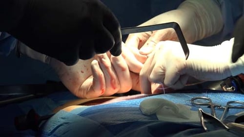 Surgical Suture Or Stitches 1