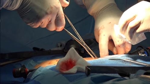 Surgical Suture Or Stitches 2