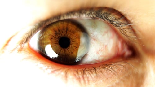Großes Auge 03