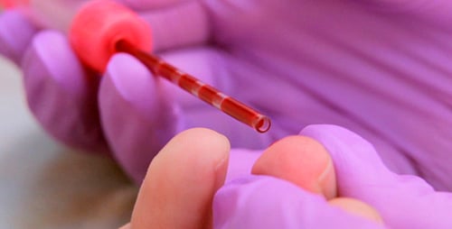 Blood Being Collected from a Finger with Gloves