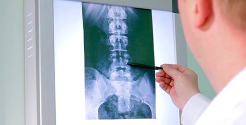 El doctor examina una radiografía 1