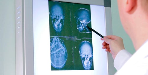 The Doctor Examines An X-Ray Picture 2