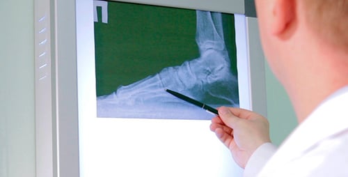 Doctor Examining Foot X-Ray on Light Board