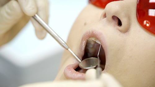 Dentist Inspecting Patient's Teeth with Mirror and Pick