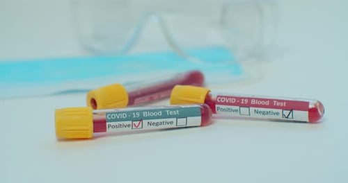 COVID-19 Blood Test Results
