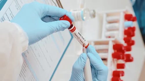Vertical Close Up of Doctors Hand Holding Tube with Blood Test SARS-CoV-3