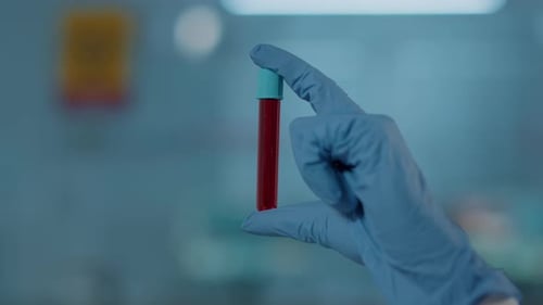 Blood Sample in Test Tube Held by Gloved Hand