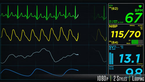 Animated Medical Monitor Display with Vital Signs and ECG Waveforms