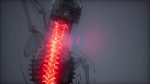 Backache in Back Bones