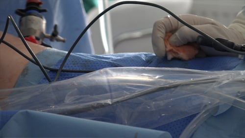 Laparoscopic Surgery