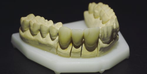 Dental Mold with Metal Framework for Healthcare Use