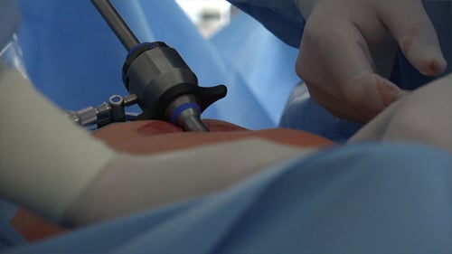 Laparoscopic Surgery