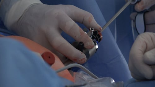 Laparoscopic Surgery