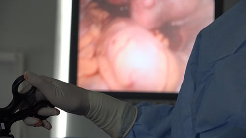 Surgeon's Hands and Monitor