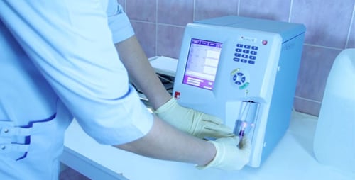 Blood Sample Analyzed by Automatic Hematology Analyzer