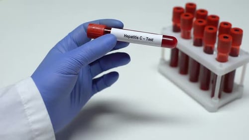 Hepatitis C Blood Test in Lab