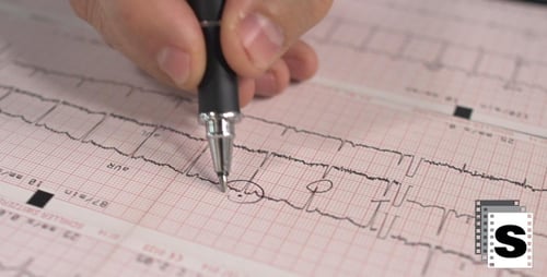 Analyzing EKG and Brain Scan in Hospital Setting