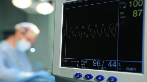 Heart Rate Monitor in Hospital Operating Room