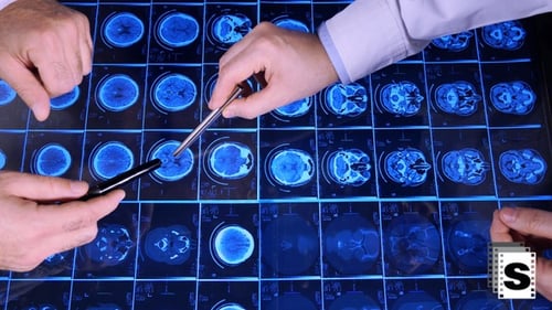 MRI Analysis