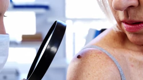 Doctor Examines Mole on Senior Patient's Shoulder