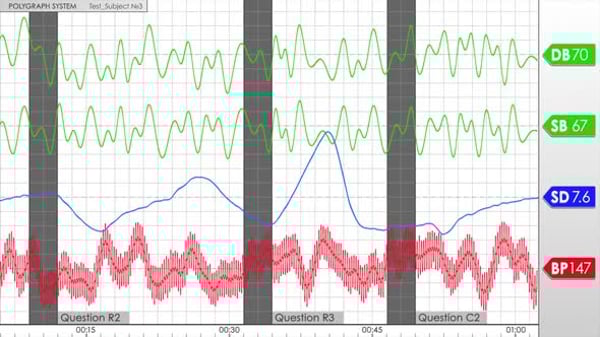 Polygraph Lie Detector Test Chart - 2 Styles, Elements Motion Graphics ...
