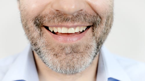 Close Up of Man Smiling Showing His Teeth