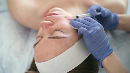 Using Dermal Filler