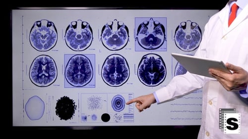 Brain Ct Examination
