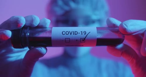 Arzt schaut sich eine COVID-19-Reagenzglasanalyse an