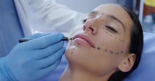 Woman Getting Face Marked for Cosmetic Surgery Procedure