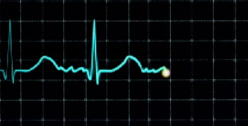 Elektrokardiogramm