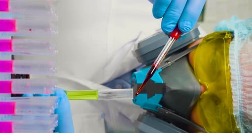 Scientist Handling Blood Sample With Pipette in Lab