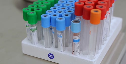 Test Tubes in a Medical Setting, Close Up