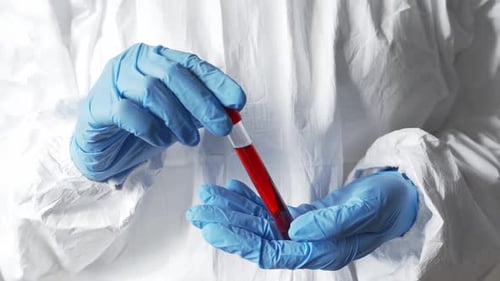Medical Lab Worker with Protective Gloves Holding Testing Blood Samples on Hospital Hands Close Up