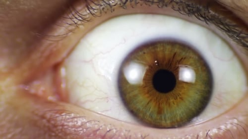 Auge der Angst.