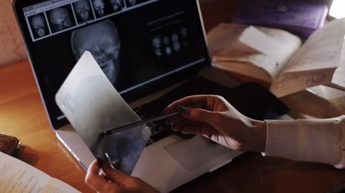 Woman Examining Skull X-Ray Film on Laptop