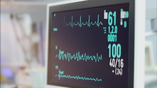 Heart Rate Monitor in Hospital Theater. Medical Vital Signs Monitor Instrument in a Hospital on