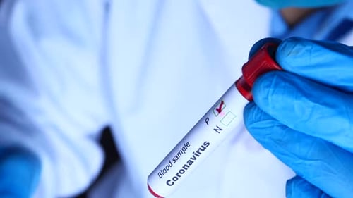 Coronavirus blood sample test tube in doctor's hands