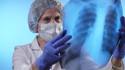 Doctor Looks at X-ray of the Lungs. Coronavirus Concept