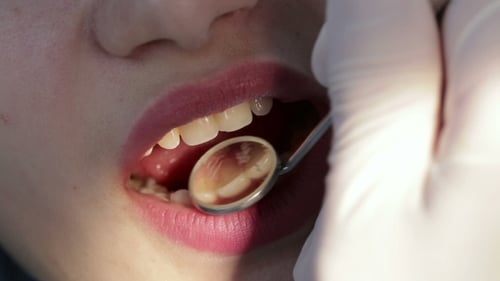 Examination of The Mouth And Teeth