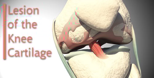 Human Knee Anatomy: ACL Ligament 3D Medical Animation