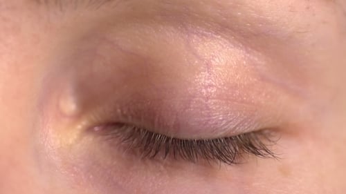 The Girl Opens Eyes
