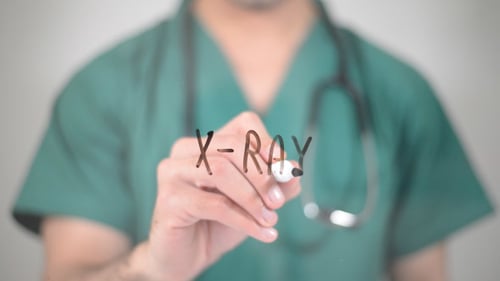 X-Ray