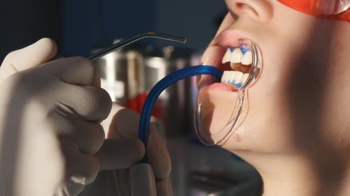 Whitening Teeth In Dental Clinic