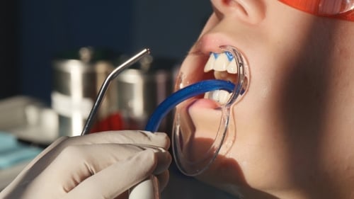 Whitening Teeth In Dental Clinic
