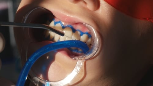 Whitening Teeth In Dental Clinic