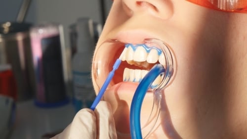 Whitening Teeth In Dental Clinic