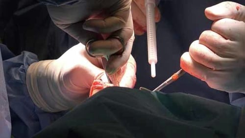 Surgeons Performing Delicate Procedure in Operating Room