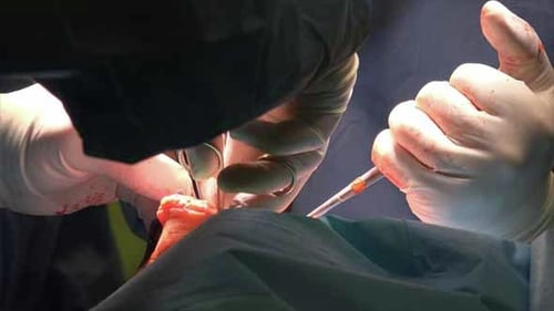 Surgery 4
